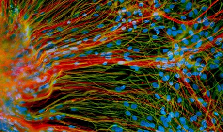 Dosplé neurony vypstované z embryonálních kmenových bunk v laboratoi...