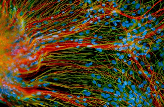 Dosplé neurony vypstované z embryonálních kmenových bunk v laboratoi...