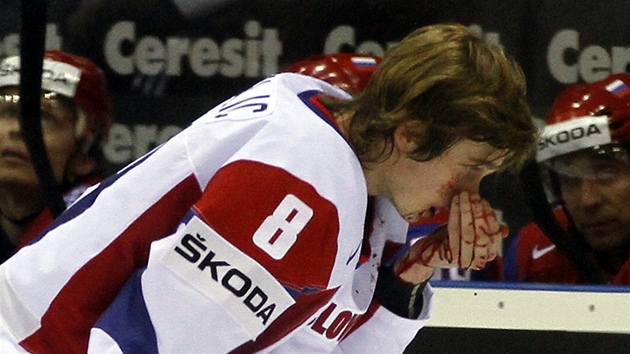 TO BOLÍ. Slovinský útočník Žiga Jeglič utrpěl ošklivou ránu v obličeji a na jeho ruku dopadá krev. I proto spěchá na střídačku.