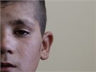 Afghánský chlapec Fazel Rahmán v kábulské polepovn pro malé sebevraedné atentátníky (14. kvtna 2011)