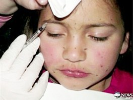 Osmilet Britney dostv injekce botoxu proti vrskm.