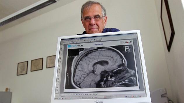 P�ednosta Neurologické kliniky Fakultní nemocnice u svaté Anny v Brn� Ivan...