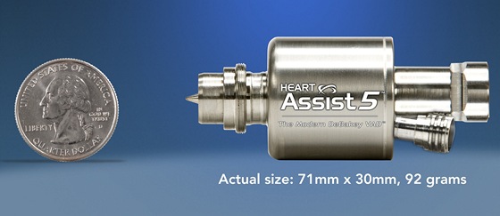 VAD - Ventricular Assist Device, umělá srdeční pumpa, která má předobraz v