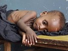 Podvyivené somálské dít leí v nemocnici v metropoli Mogadiu. (8. ervence