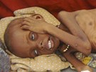 Podvyivené somálské dít leí na zemi nemocnice v Mogadiu (5. ervence 2011)
