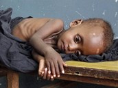 Podvyiven somlsk dt le v nemocnici v metropoli Mogadiu. (8. ervence