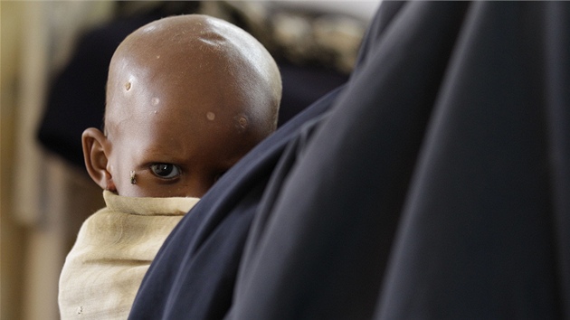 Somálské podvyživené dítě v náručí své matky v nemocnici provozované