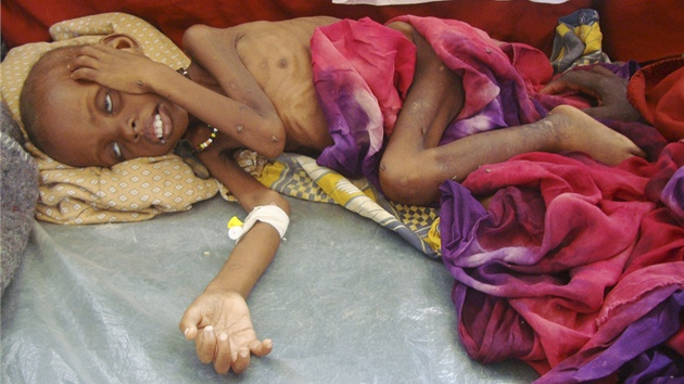 Podvyživené somálské dítě leží na zemi nemocnice v Mogadišu (5. července 2011)