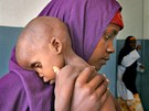 Podvyživený dvouletý Lul Ibrahim se svou matkou čekají na zdravotní pomoc v