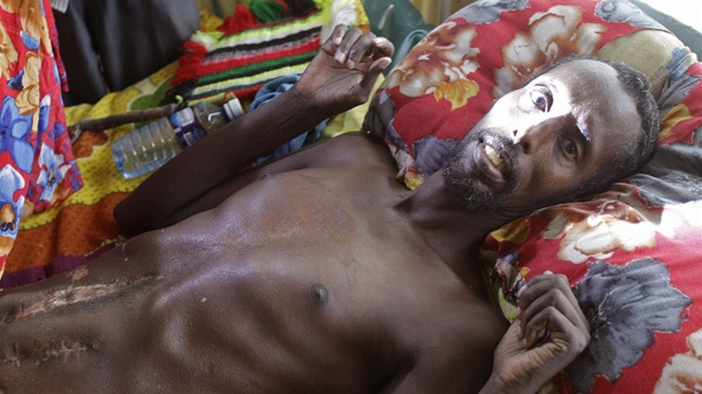 Hladomor v Somálsku ohrouje miliony lidí.