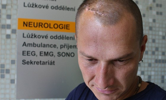 Tři týdny po mačetovém útoku vytáhli lékaři nejhůře zraněnému Lukáši Haškovi z hlavy 40 stehů.
