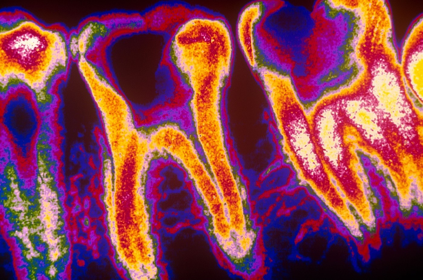 Fluoridovaná voda - jed, nebo preventivní lé�ba? Konspiráto�i jsou si jistí, �e jde o trik mocných, jak ovládnout obyvatelstvo.