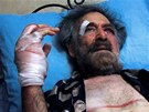 Zbitý karikaturista Alí Farzat v damaské nemocnici (25. srpna 2011)