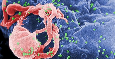 Virus HIV (zelen) na bílé krvince