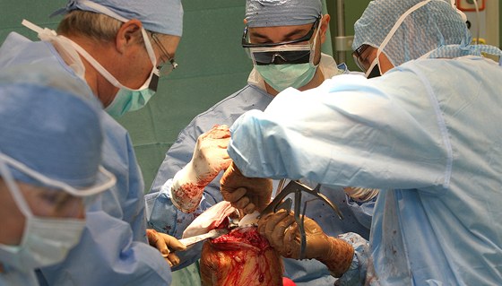 Ortopedi plzeské Fakultní nemocnice provádjí operaci endoprotézy kolenního