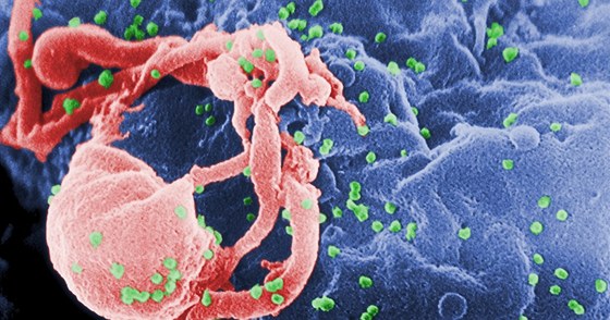 Virus HIV (zeleně) na bílé krvince
