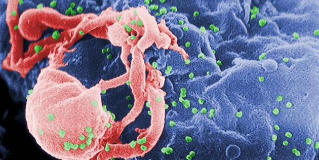 Virus HIV (zelen�) na bílé krvince