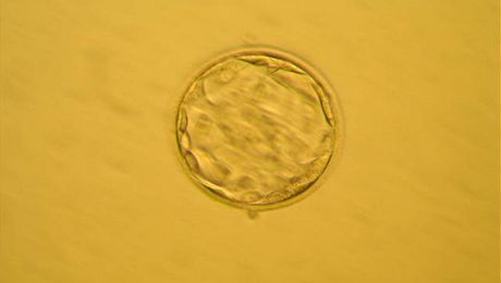 Embryo ve stádiu blastocysty (po 120 hodinách). Ilustraní foto