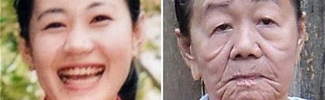 Vietnamka Nguyen Thi Phuong v jednadvaceti a v estadvaceti letech