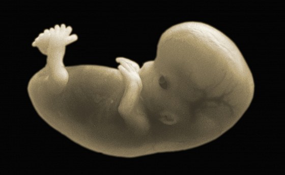 Nejčastější příčiny samovolných potratů jsou genetického původu (ilustrační snímek)