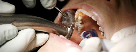 Nkteí pacienti do ordinace ani nepili, pesto na n zubaka vykázala zákrok. Ilustraní foto
