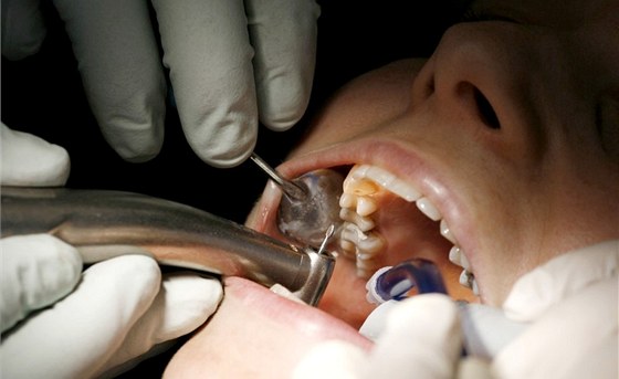 Někteří pacienti do ordinace ani nepřišli, přesto na ně zubařka vykázala zákrok. Ilustrační foto