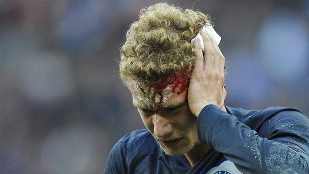 KREV CR Z HLAVY. Fabian Lustenberger z Herthy Berln dostal nepjemn der do hlavy a v bolestech opout hit.