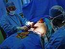 Sehraný chirurgický tým dokonuje plastickou operaci bicha paní Jaroslavy.