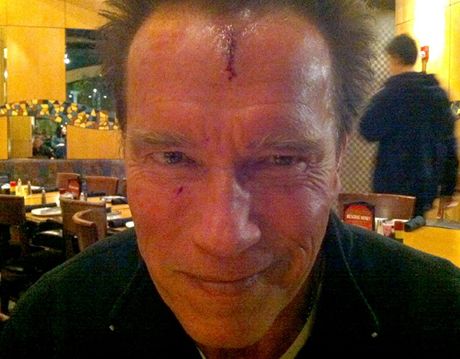 Arnold Schwarzenegger si pi natáení rozsekl elo
