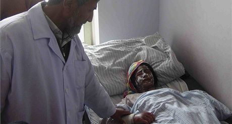 Léka v afghánské nemocnici ve mst Kunduz oetuje enu, kterou popálili útoníci kyselinou. (30. listopadu 2011). Ilustraní snímek