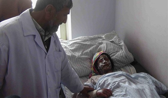 Léka v afghánské nemocnici ve mst Kunduz oetuje enu, kterou popálili