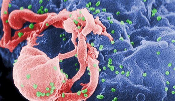 Snímek viru HIV