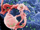 Snímek z elektronového mikroskopu zachycuje virus HIV (variantu HIV-1). Zelené...