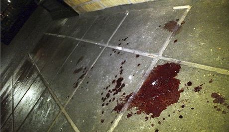 Policisté mladíka nali v tratoliti krve. (Ilustraní snímek)
