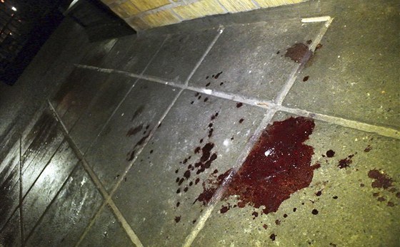 Vrah na Litovelsku vraždil nožem, po potyčce utekl. (ilustrační snímek)