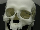 Rekonstruovan� lebka 