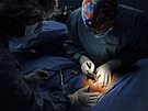 Výmna implantát PIP - po operaci bude mít pacienta zase jen jednu jizvu, jako