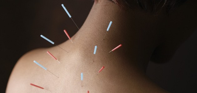 Bolavým �ech�m pom��e �ínská medicína, tabletky nahradí akupuktura. Ilustra�ní snímek