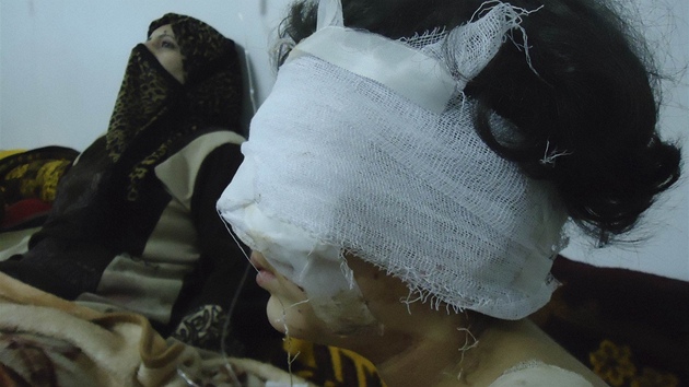 Holika zranná pi ostelování msta Homs (6. února 2012)