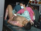 Zdravotníci peují o popálené trestance v honduraské metropoli (15. února 2012)