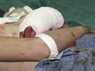 Chlapec zranný bhem vlny atentát v Bagdádu (23. února 2012)