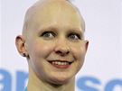 Britská cyklistka Joanna Rowsell trpí alopecií.Léta si prý chodila pro medaili...