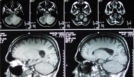 Mladík ml doklad s diagnózou od praktického lékae s faleným potvrzením Fakultní Thomayerovy nemocnice. Ilustraní snímek