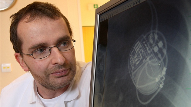 Primá� radiodiagnostického odd�lení jablonecké nemocnice Jaromír Frydrych