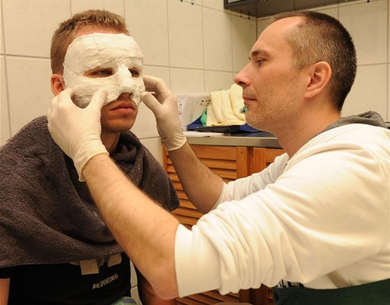 Specialista vyrábí Michalu Kadlecovi ochrannou masku. eský fotbalista tak bude