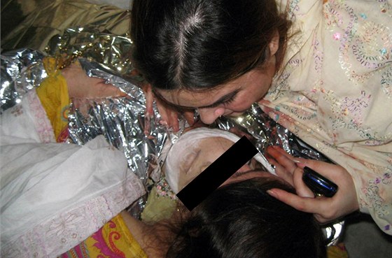 Zastelená pákistáncká zpvaka Ghazala Davedová v nemocnici v Péávaru (19.
