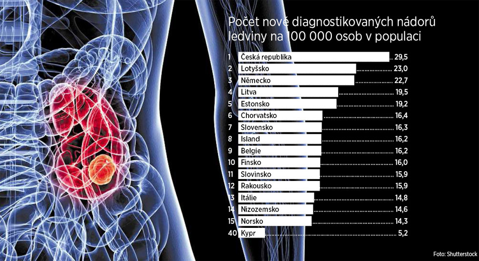 Poet nov diagnostikovanch ndor ledviny na 100 000 osob v populaci