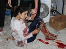 Syrská ena zranná pi ostelování Homsu (24. ervna 2012)