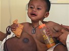 Malý chlapec ml na tle nádor, který byl t잚í ne on sám (14. ervna 2012)