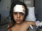 Syrská holika zranná pi ostelování msta Húlá (15. ervence 2012)